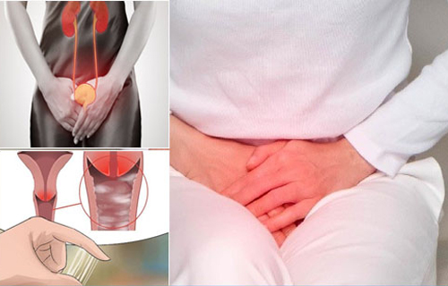 Viêm âm đạo: Nguyên nhân, triệu chứng, phương pháp điều trị