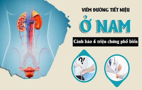 Cảnh Báo Các Triệu Chứng Viêm Đường Tiết Niệu Ở Nam Giới