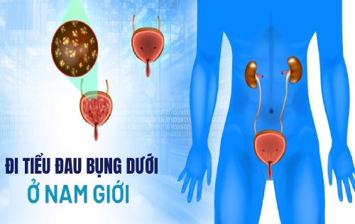 Điểm Mặt Các Bệnh Lý Tiềm Ẩn Khi Đi Tiểu Đau Bụng Dưới